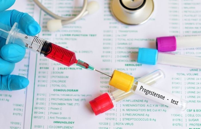 A Progesterone Test For Dogs? Exploring CANINE Ovulation Testing 1 I Love Veterinary - Blog for Veterinarians, Vet Techs, Students Progesterone Test For Dogs